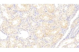 Detection of ANG in Human Kidney Tissue using Polyclonal Antibody to Angiogenin (ANG) (ANG anticorps  (AA 25-147))
