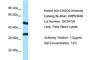 Western Blotting (WB) image for anti-Calsequestrin 2 (CASQ2) (N-Term) antibody (ABIN970293) (CASQ2 anticorps  (N-Term))