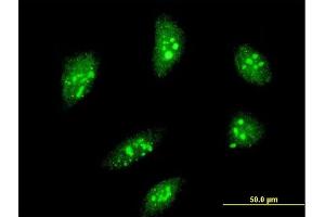 Immunofluorescence of monoclonal antibody to MEOX2 on HeLa cell. (MEOX2 anticorps  (AA 1-303))