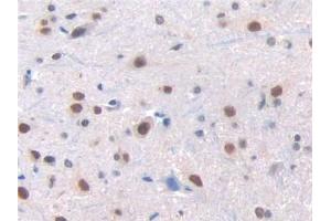 DAB staining on IHC-P; Samples: Rat Spinal cord Tissue