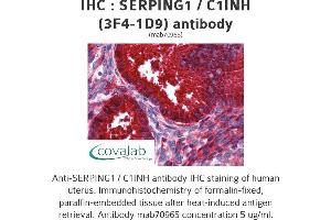 Image no. 2 for anti-Serpin Peptidase Inhibitor, Clade G (C1 Inhibitor), Member 1 (SERPING1) (AA 1-501), (full length) antibody (ABIN1723814)