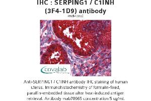 Image no. 2 for anti-Serpin Peptidase Inhibitor, Clade G (C1 Inhibitor), Member 1 (SERPING1) (AA 1-501), (full length) antibody (ABIN1723814) (SERPING1 anticorps  (full length))