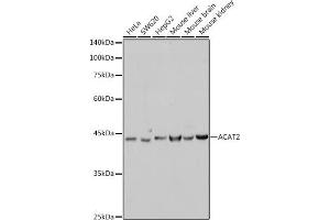 Western blot analysis of extracts of various cell lines, using  antibody (ABIN7265364) at 1:1000 dilution. (ACAT2 anticorps)