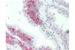 Anti-PAK4 antibody IHC staining of human prostate.