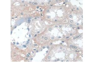 DAB staining on IHC-P Samples:Human Kidney Tissue) (APOA1 anticorps  (AA 122-267))