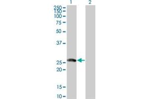 Western Blot analysis of BTG4 expression in transfected 293T cell line by BTG4 monoclonal antibody (M07), clone 1A6. (BTG4 anticorps  (AA 1-206))