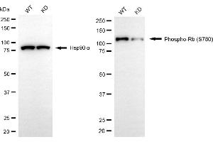 Western blotting analysis using phospho-Rb (S780) antibody (ABIN7800187). (Recombinant Retinoblastoma Protein (Rb) anticorps  (pSer780))