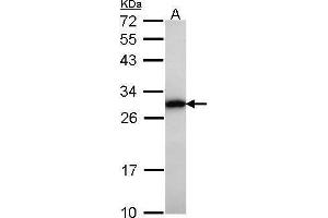 WB Image Sample (30 ug of whole cell lysate) A: Raji 12% SDS PAGE GRB2 antibody antibody diluted at 1:1000 (GRB2 anticorps  (C-Term))