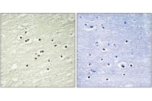 Immunohistochemistry analysis of paraffin-embedded human brain tissue, using Cyclin H (Ab-315) Antibody.