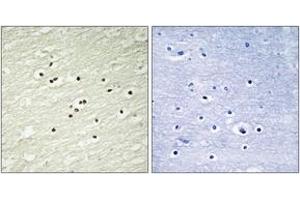 Immunohistochemistry analysis of paraffin-embedded human brain tissue, using Cyclin H (Ab-315) Antibody. (Cyclin H anticorps  (AA 274-323))
