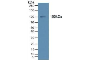 Detection of Tie2 in Human Serum using Polyclonal Antibody to TEK Tyrosine Kinase, Endothelial (Tie2) (TEK anticorps  (AA 286-465))