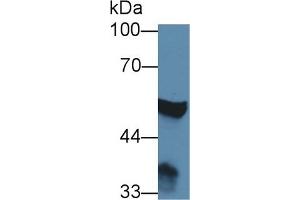 Detection of ABAT in Rat Cerebrum lysate using Polyclonal Antibody to 4-Aminobutyrate Aminotransferase (ABAT) (ABAT anticorps  (AA 236-500))