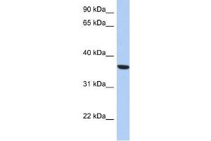PSTK antibody used at 1 ug/ml to detect target protein. (PSTK anticorps  (Middle Region))