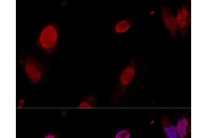 Confocal immunofluorescence analysis of U-2OS cells using PTBP1 Polyclonal Antibody at dilution of 1:50. (PTBP1 anticorps)