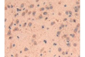 Detection of LOXL3 in Mouse Cerebrum Tissue using Polyclonal Antibody to Lysyl Oxidase Like Protein 3 (LOXL3)