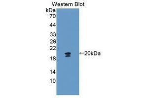 Detection of Recombinant GYPA, Mouse using Polyclonal Antibody to Glycophorin A (GYPA) (CD235a/GYPA anticorps  (AA 1-108))