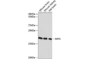 Western blot analysis of extracts of various cell lines, using  Rabbit mAb (ABIN7265485) at 1:1000 dilution. (ARF6 anticorps)