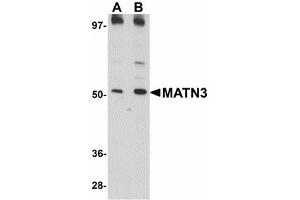 Image no. 1 for anti-Matrilin 3 (MATN3) (C-Term) antibody (ABIN478072) (Matrilin 3 anticorps  (C-Term))