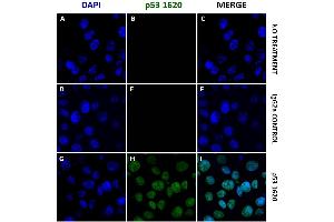 MCF-7 breast cancer cells were treated with (D – I) or without (A – C) 50 nM dox for 24 hrs, incubated with IgG2a isotype control or anti-p53 (ABIN2704419) diluted 1:1000.
