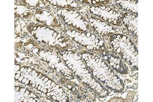 IHC analysis of Galectin 2/LGALS2 using anti-Galectin 2/LGALS2 antibody (ABIN7598979). (Galectin 2 anticorps  (AA 1-132))