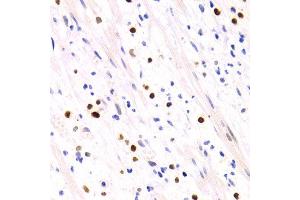 Immunohistochemistry of paraffin-embedded human appendicitis using GEMIN2 antibody at dilution of 1:200 (400x lens). (SIP1 anticorps)