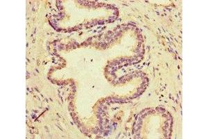 Immunohistochemistry of paraffin-embedded human prostate cancer using ABIN7160306 at dilution of 1:100 (Multicilin anticorps  (AA 3-110))