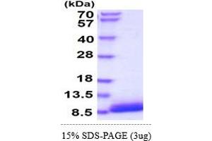 Epidermal Growth Factor (EGF) (AA 977-1029) (Active) protein (His tag)