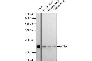 Western blot analysis of extracts of various cell lines, using eIF1A antibody (ABIN7267027) at 1:1000 dilution. (Eukaryotic Translation Initiation Factor 1A (EIF1A) anticorps)
