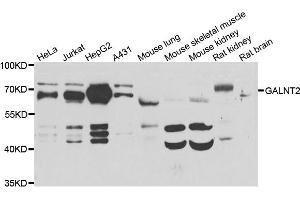 Western blot analysis of extracts of various cell lines, using GALNT2 antibody (ABIN5974158) at 1/1000 dilution. (GALNT2 anticorps)