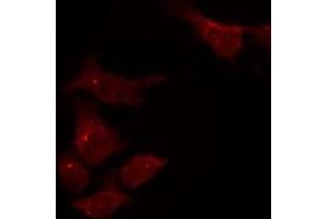 ABIN6275055 staining HepG2 by IF/ICC. (DHRS4 anticorps  (C-Term))
