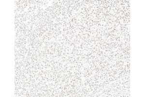 Immunohistochemistry (IHC) image for anti-Enhancer of Zeste Homolog 2 (EZH2) (C-Term) antibody (ABIN7795724) (Recombinant EZH2 anticorps  (C-Term))