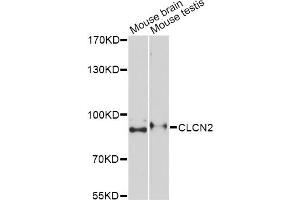 Western blot analysis of extracts of various cell lines, using CLCN2 Antibody. (CLCN2 anticorps)