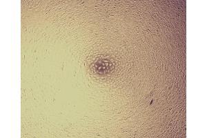 Cell proliferation of A549 cells cultured in DMEM after stimulation with GREM1 (1 ng/ml) for 96h. (GREM1 Protéine)