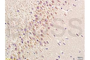 Formalin-fixed and paraffin embedded rat brain labeled with Anti-Phospho-PERK(Thr980) Polyclonal Antibody, Unconjugated (ABIN744713) at 1:200 followed by conjugation to the secondary antibody and DAB staining (PERK anticorps  (pThr980))