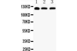 Anti-SIRT1 Picoband antibody,  All lanes: Anti SIRT1  at 0. (SIRT1 anticorps  (AA 112-311))
