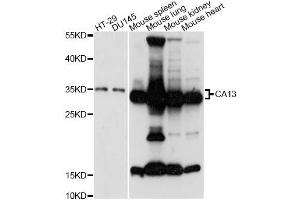 Western blot analysis of extracts of various cell lines, using CA13 antibody (ABIN6292753) at 1:3000 dilution.