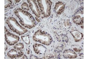 Image no. 1 for anti-Cullin 4B (CUL4B) (AA 1-300) antibody (ABIN1490724)