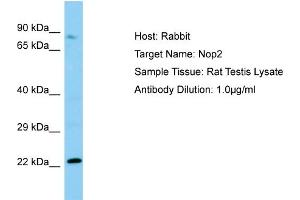 WB Suggested Anti-Nop2 Antibody   Titration: 1. (Nucleolar Protein 1 (NOL1) (N-Term) anticorps)
