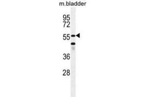 Western Blotting (WB) image for anti-SHQ1 Homolog (SHQ1) antibody (ABIN5015959) (SHQ1 anticorps)
