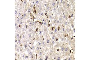 Immunohistochemistry of paraffin-embedded Human liver injury using SPN antibody at dilution of 1:100 (x400 lens). (CD43 anticorps)