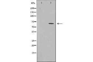 Western blot analysis of extracts from COLO cells using GBP3 antibody.