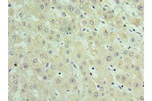 Immunohistochemistry of paraffin-embedded human liver tissue using ABIN7159904 at dilution of 1:100 (TIMM21 anticorps  (AA 1-248))