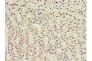 Immunohistochemistry of paraffin-embedded human adrenal gland tissue using ABIN7173199 at dilution of 1:100 (TMEM31 anticorps  (AA 1-118))