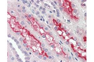 Immunohistochemical analysis of paraffin-embedded human kidney tissues using FER mouse mAb.
