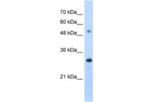 Western Blotting (WB) image for anti-PSME3 (PSME3) antibody (ABIN2462949) (PSME3 anticorps)