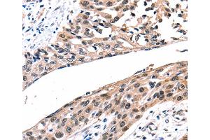 Immunohistochemistry (IHC) image for anti-Gap Junction Protein, beta 2, 26kDa (GJB2) antibody (ABIN2425961) (GJB2 anticorps)