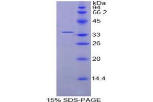 SDS-PAGE analysis of Chicken Cyclin D1 Protein. (Cyclin D1 Protein (CCND1))