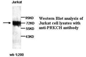 Image no. 1 for anti-Protein Kinase C, eta (PRKCH) antibody (ABIN790881) (PKC eta anticorps)