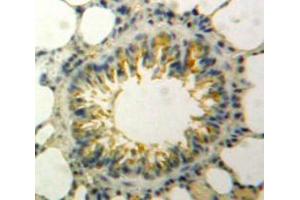 Used in DAB staining on fromalin fixed paraffin-embedded Lung tissue
