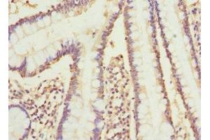 Immunohistochemistry of paraffin-embedded human small intestine tissue using ABIN7149242 at dilution of 1:100